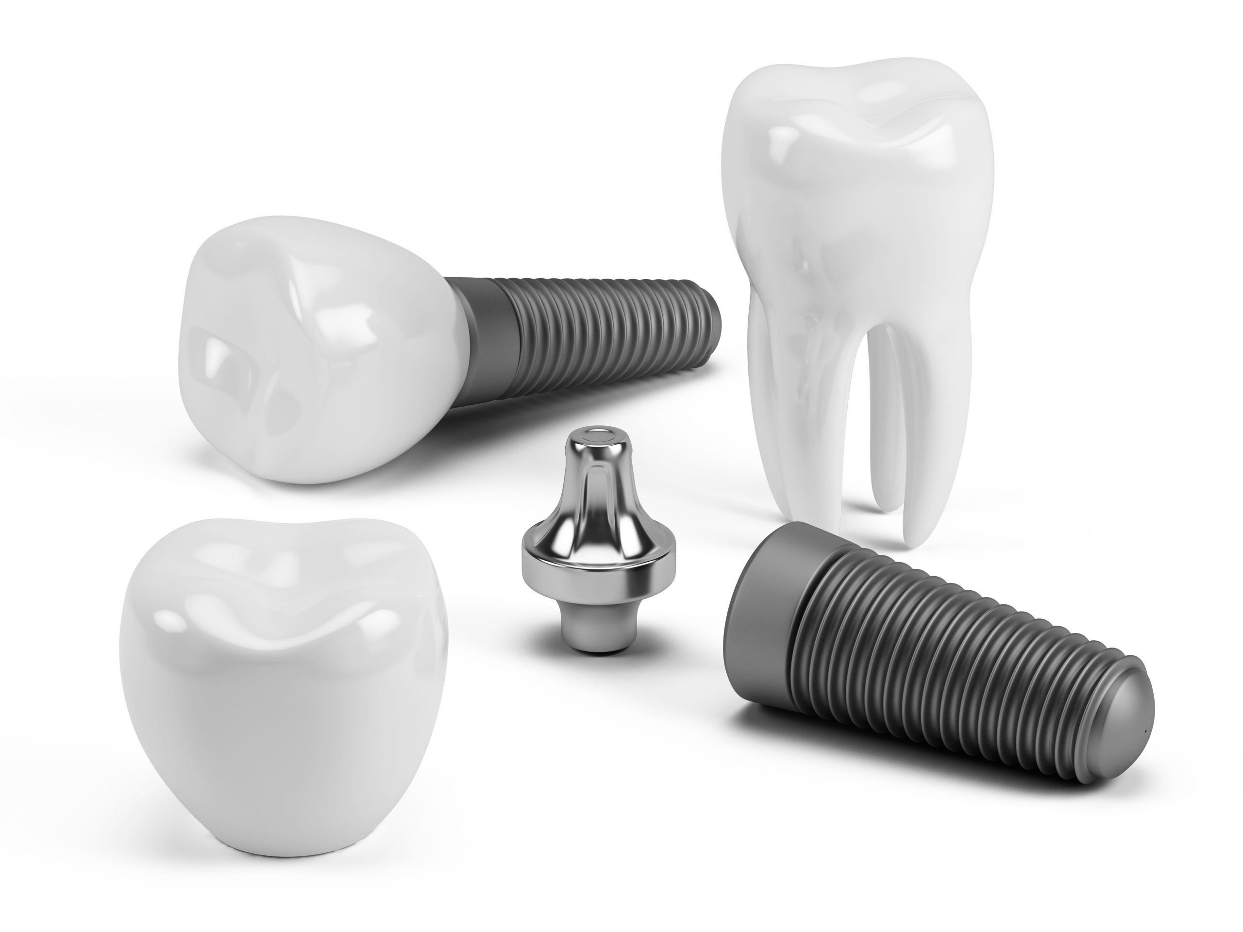 cbct dental implant part